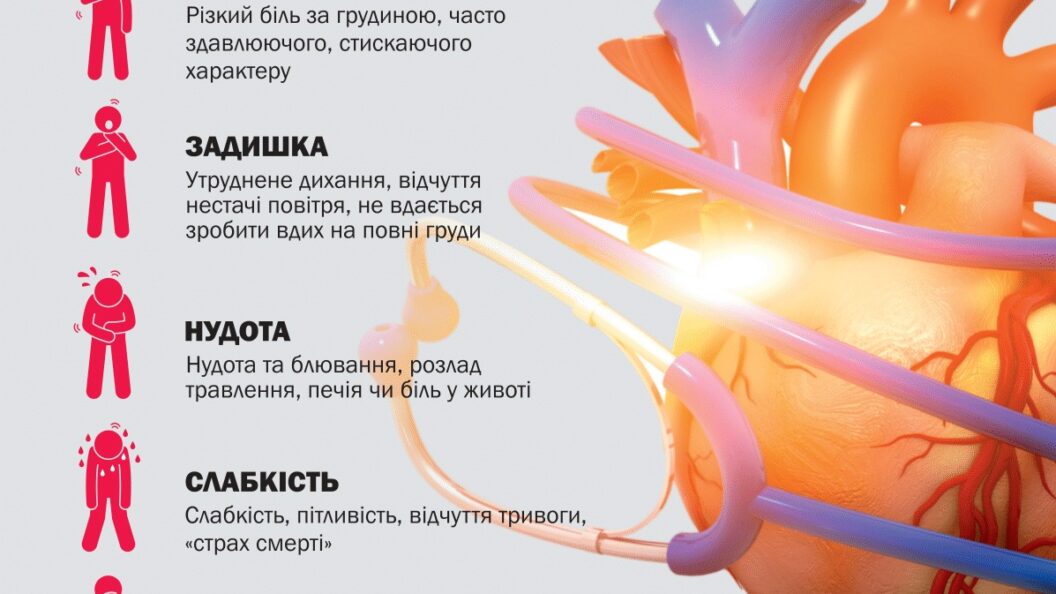 Інфаркт міокарда