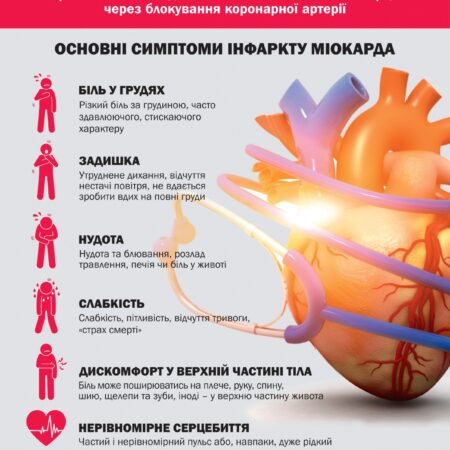 Інфаркт міокарда